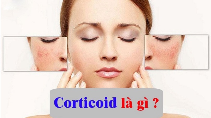 Corticoid là gì? Corticoid (tên đầy đủ là glucocorticoid) là một loại thuốc kháng viêm được chỉ định trong nhiều bệnh lý khác nhau.